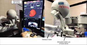 Hệ thống sinh thiết tuyến tiền liệt dưới hướng dẫn siêu âm kết hợp hình ảnh MRI